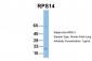 RPS14 antibody - middle region